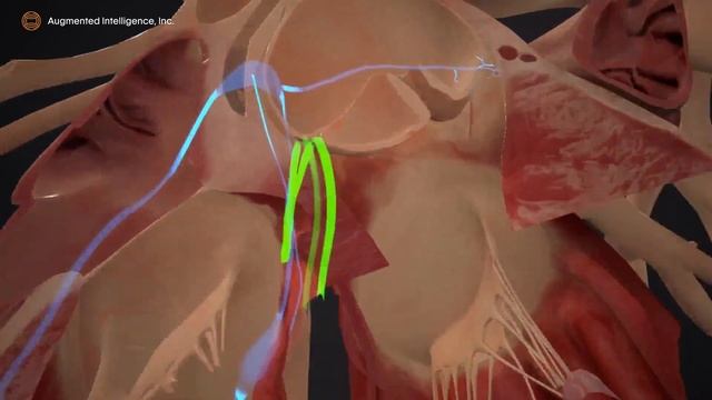 BodyMap Introduction смотреть онлайн