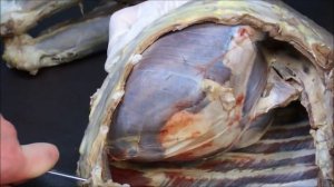 мышцы грудных стенок