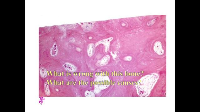 Basic Pathology - Revision / Non-interactive quiz (UCL MMB Pathology 6) смотреть онлайн