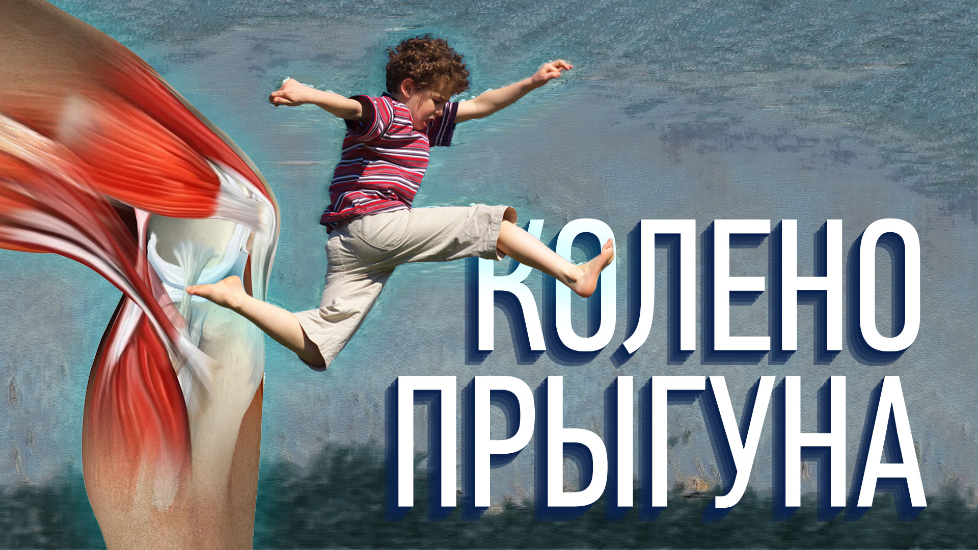 Тенденопатия собственной связки надколенника. Колено прыгуна. Как помочь своему колену? смотреть онлайн