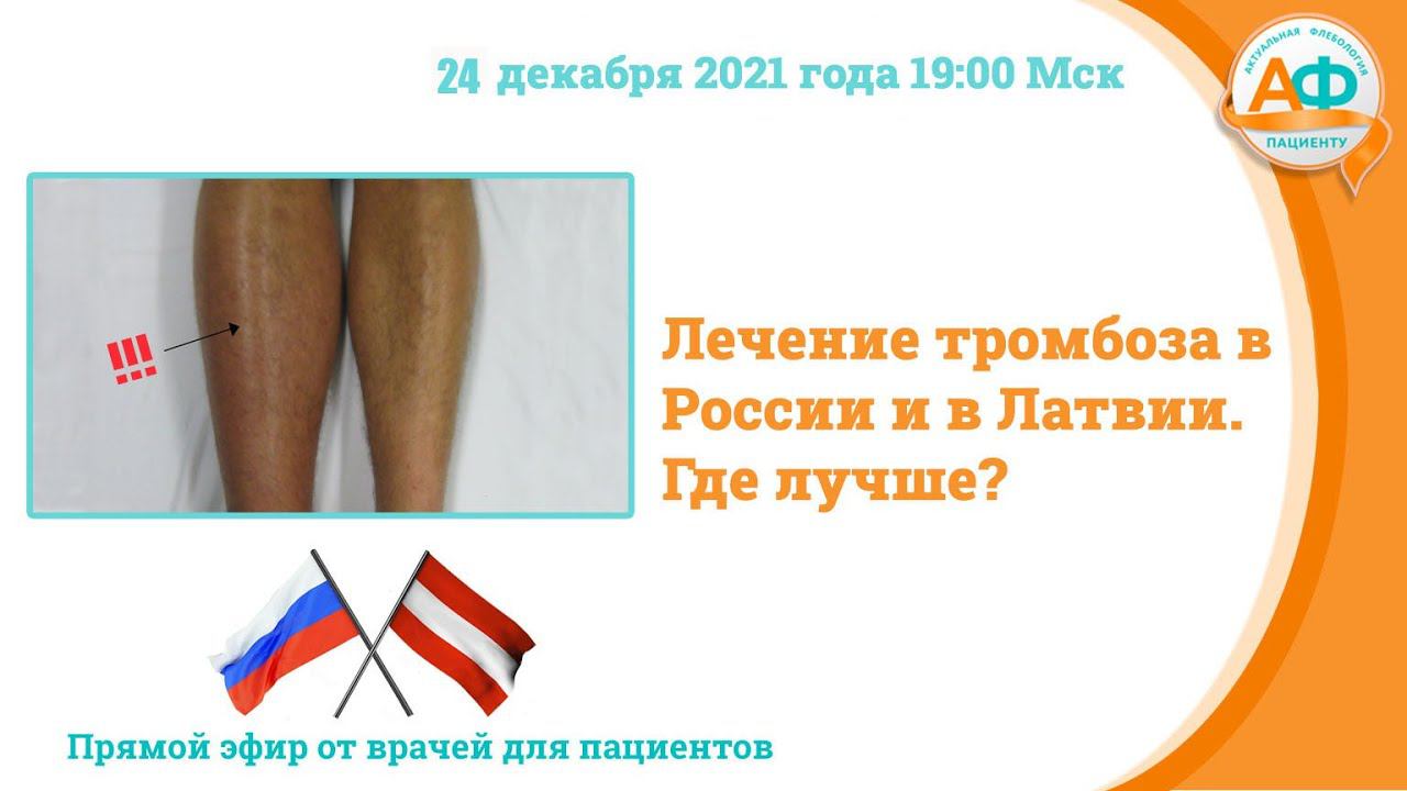 Лечение тромбоза в Латвии и России. Где лучше? смотреть онлайн