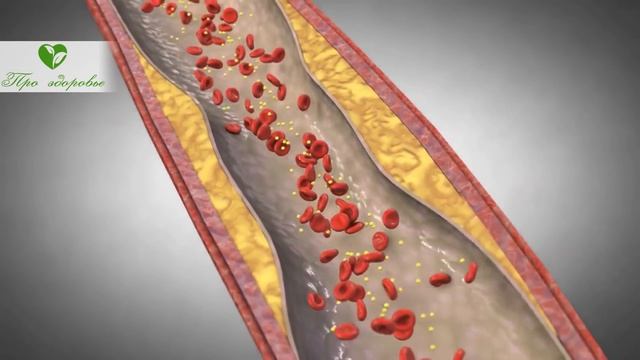 Не выбрасывай и не глотай! Колоссальную пользу сердцу несут виноградные косточки, когда… смотреть онлайн