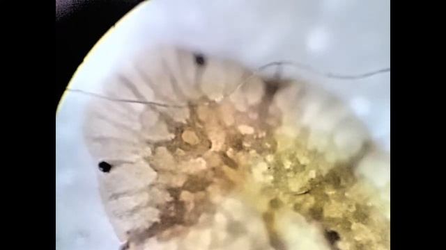 Щитовка , подробное изучение строения смотреть онлайн