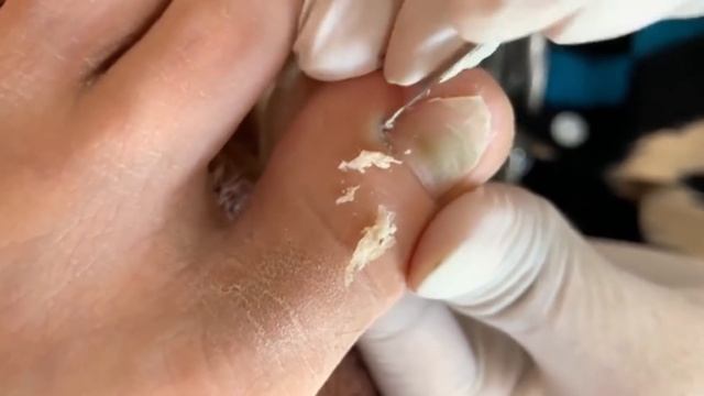 How To Repair Nails Easy # 469 - Xuyen Nail