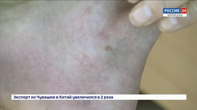 13 жителей Чувашии обратились за медицинской помощью после укуса змей за последний месяц смотреть онлайн