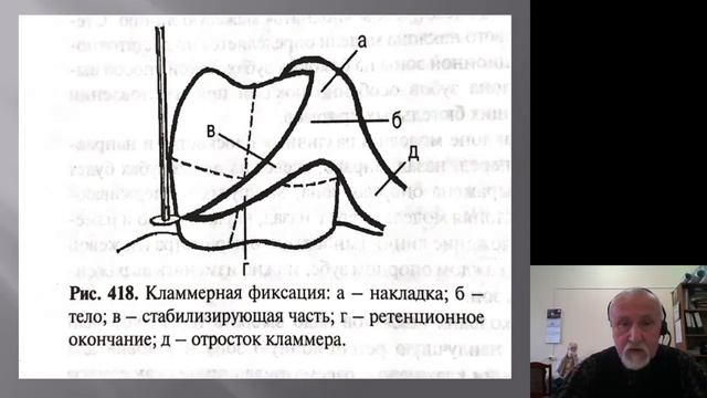 Простое протезирование. Параллелометрия смотреть онлайн
