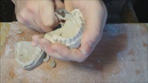 Съёмные зубные протезы. Делаем прикусной валик.