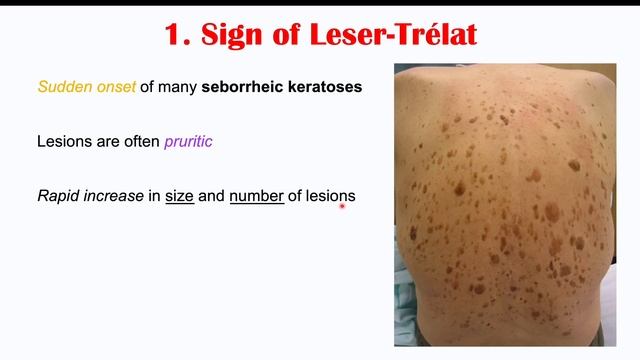3 Weird Signs of Colon Cancer (Found on the Skin) смотреть онлайн