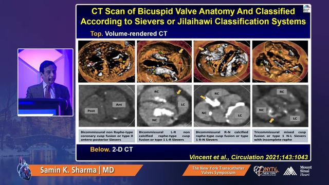 Top Ten Advances in Transcatheter Valve Therapy 2021 Samin K Sharma, MD смотреть онлайн
