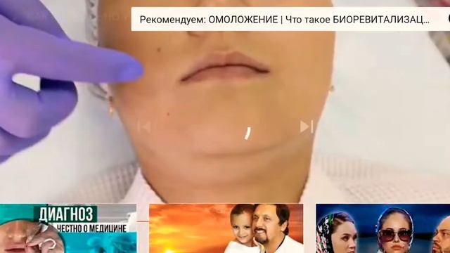 Коррекция губ. Как правильно увеличить губы! смотреть онлайн