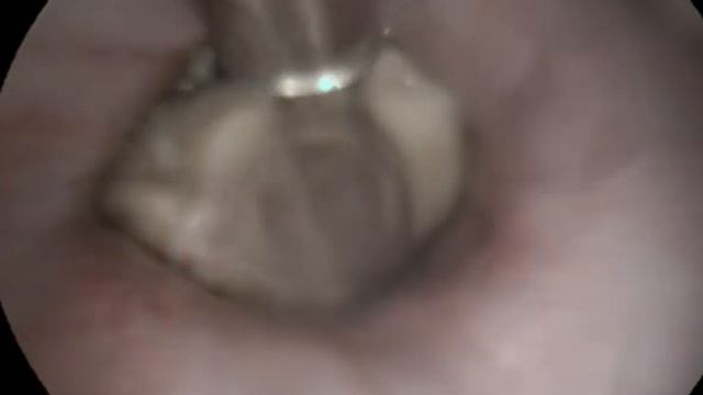 Извлечение крупных инородных тел пищевода желудка собак кошек смотреть онлайн