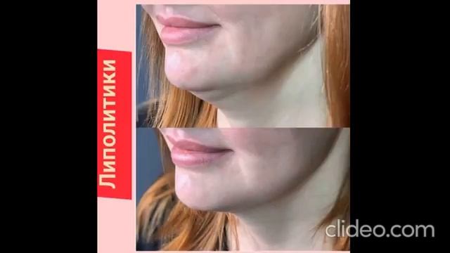 Услуги косметолога. Адрес: Ставропольский край, г. Георгиевск Звоните: +7 (928) 316-02-74 Инна смотреть онлайн