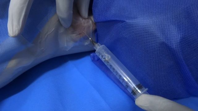 (FNAC)Fine Needle Aspiration Cytology Practical Complete Procedure in Hindi/Urdu смотреть онлайн