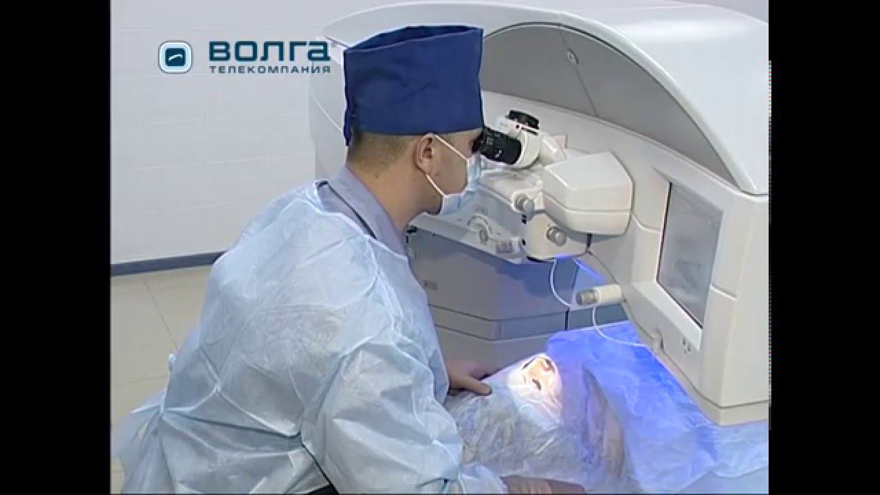 Фемто-кросслинкинг. Кросслинкинг. Лечение кератоконуса смотреть онлайн