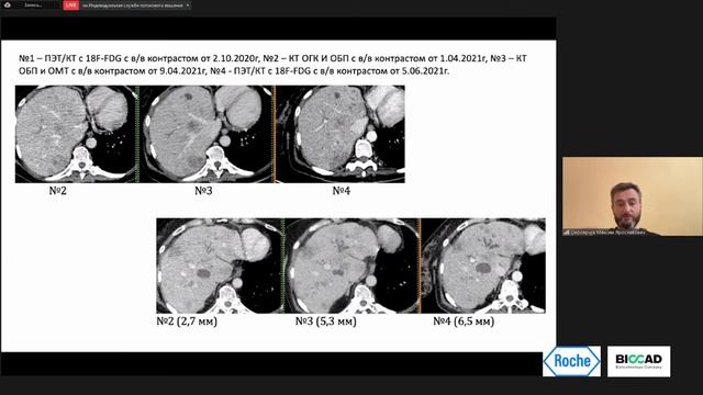 ПЭТ/КТ по ОМС - кому, когда и почему смотреть онлайн