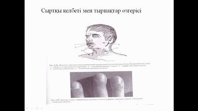 Тыныс алу ағзалары ауруларының шағымдарын смотреть онлайн