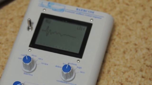 BAER Test. Znatnaya Osoba Iz Nienshansa