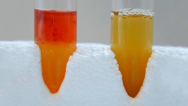 Voges-Proskauer Test - Amrita University смотреть онлайн