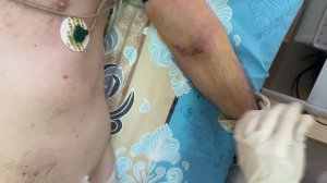 Забор крови на стерильность