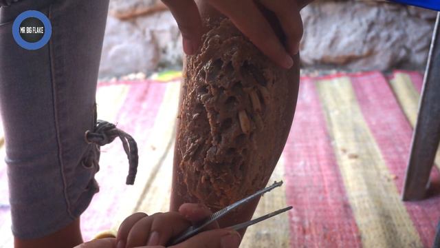 [ Worms Body ] How to Remove Worms On Dandruff #347 смотреть онлайн