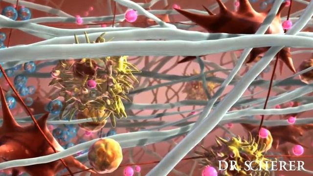 Как работает Sculptra?