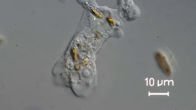Mayorella sp., a freshwater amoeba. смотреть онлайн
