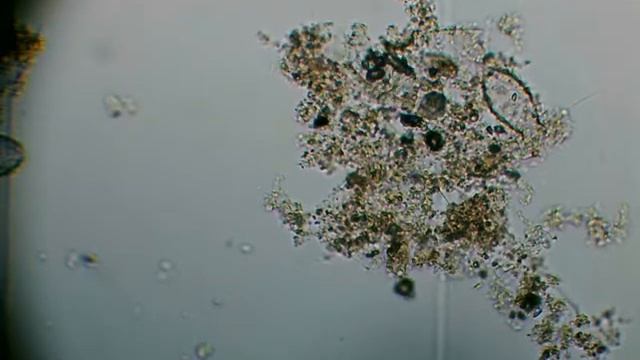 Круглый червь Нематода. Nematoda. смотреть онлайн