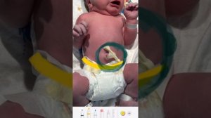 Обработка пупка у новорождённого! Только современные рекомендации.