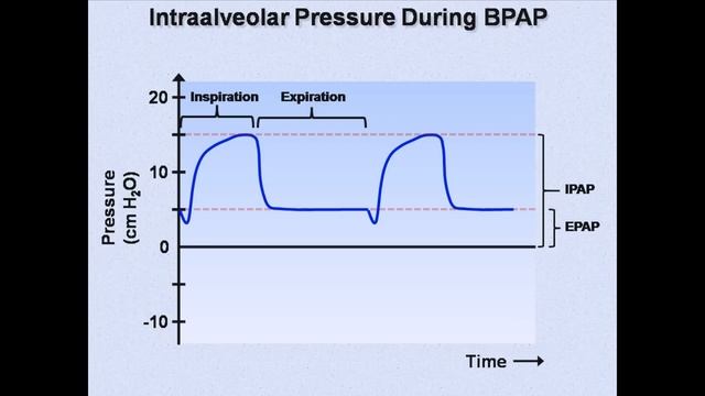 Non-Invasive Positive Pressure Ventilation (Mechanical Ventilation - Lecture 6)