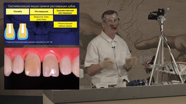 Реконструкция зубных рядов: устранение диастемы и трем смотреть онлайн