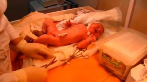 Первый день-обрезка пуповины