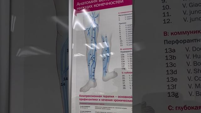 Тазовый варикоз. Как лечить варикоз? Лечение варикоза. Сосудистый хирург. Флеболог Москва. Флеболог смотреть онлайн