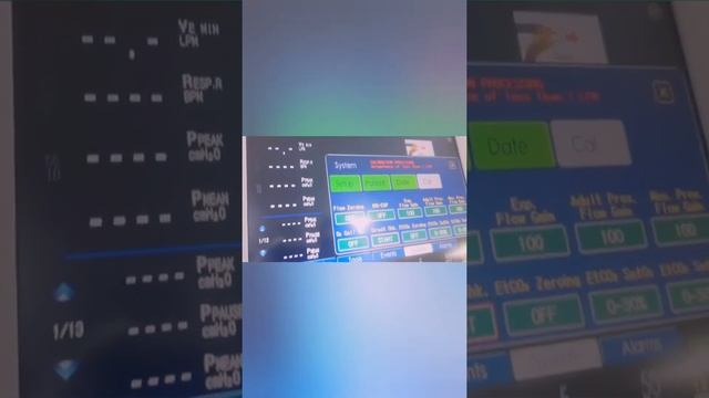MEKICS SU: MV2000 VENTILATOR PRE-USE CHECK AND CALIBRATION смотреть онлайн