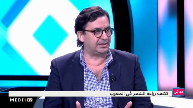 Dr Alami Mohamed زراعة الشعر ومشاكل التساقط смотреть онлайн
