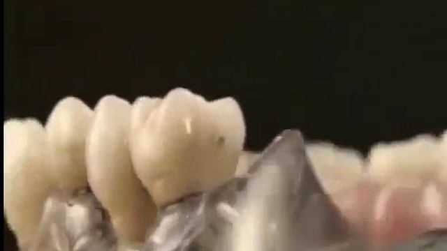 Ортопедия в стоматологии. Лучшая стоматологическая клиника в СПБОртопедия в стоматологии. Лучшая сто смотреть онлайн