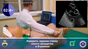 ЭХО КГ. Парастернальный доступ - длинная ось левого желудочка