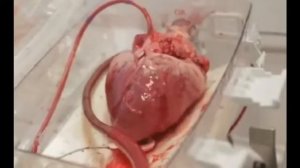 Как работает сердце человека