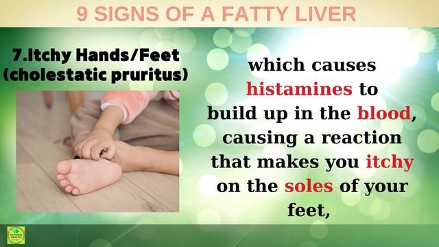 Be Careful! If You Have These Symptoms, You May Have FATTY LIVER Disease.(9 Early Sings) смотреть онлайн