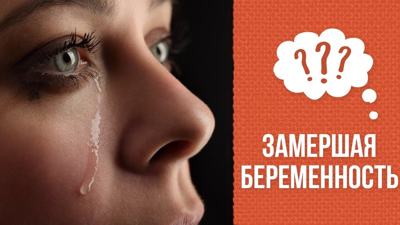 Почему случается замершая беременность смотреть онлайн