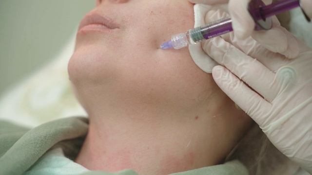 Биоревитализация смотреть онлайн