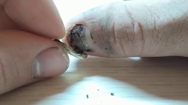 Отрываю себе ноготь