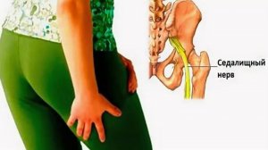 Боли в области СЕДАЛИЩНОГО нерва исчезают после ванночки для ног из воды, уксуса и соли!