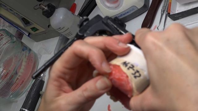 Festooning Denture Setup from Class 1 to Class 3 смотреть онлайн