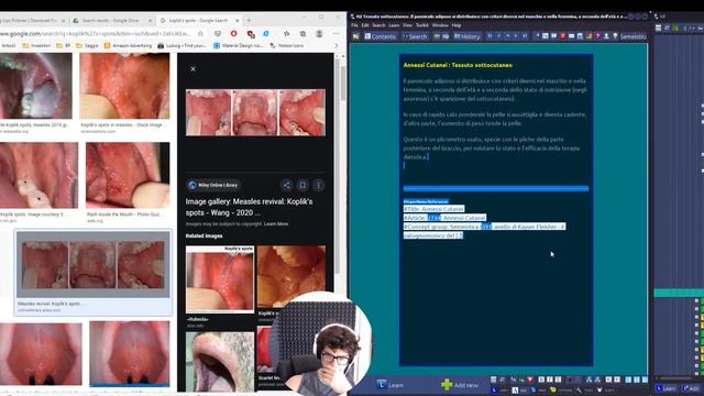 Incremental Learning 1.30 h in 10 minutes - Fowl (COMMENTED!) смотреть онлайн
