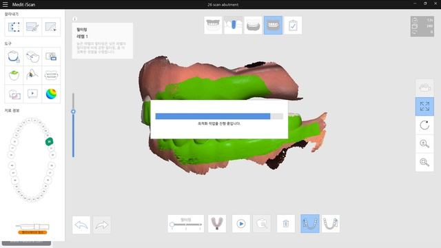 Case1 #1 scanning #26 'Dentium scan abutment' using Medit Link(i500) смотреть онлайн