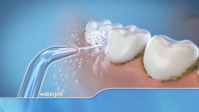Видео про ирригатор Waterpik смотреть онлайн