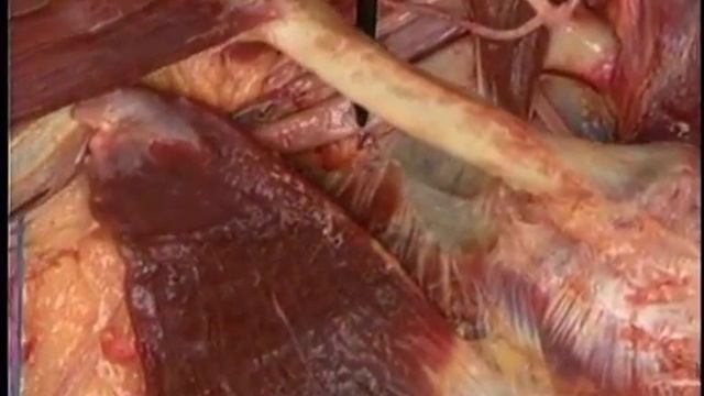 подключичная, подмышечная артерии смотреть онлайн