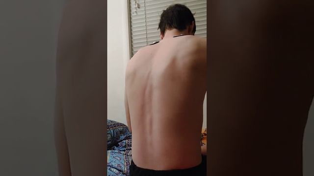 acupuncture with electrical muscle stimulation смотреть онлайн