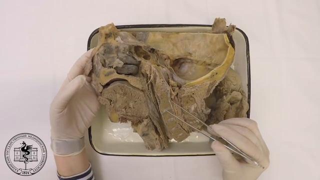 Спланхнология, анатомия глотки смотреть онлайн