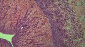 Разбор гистологического препарата: Матка